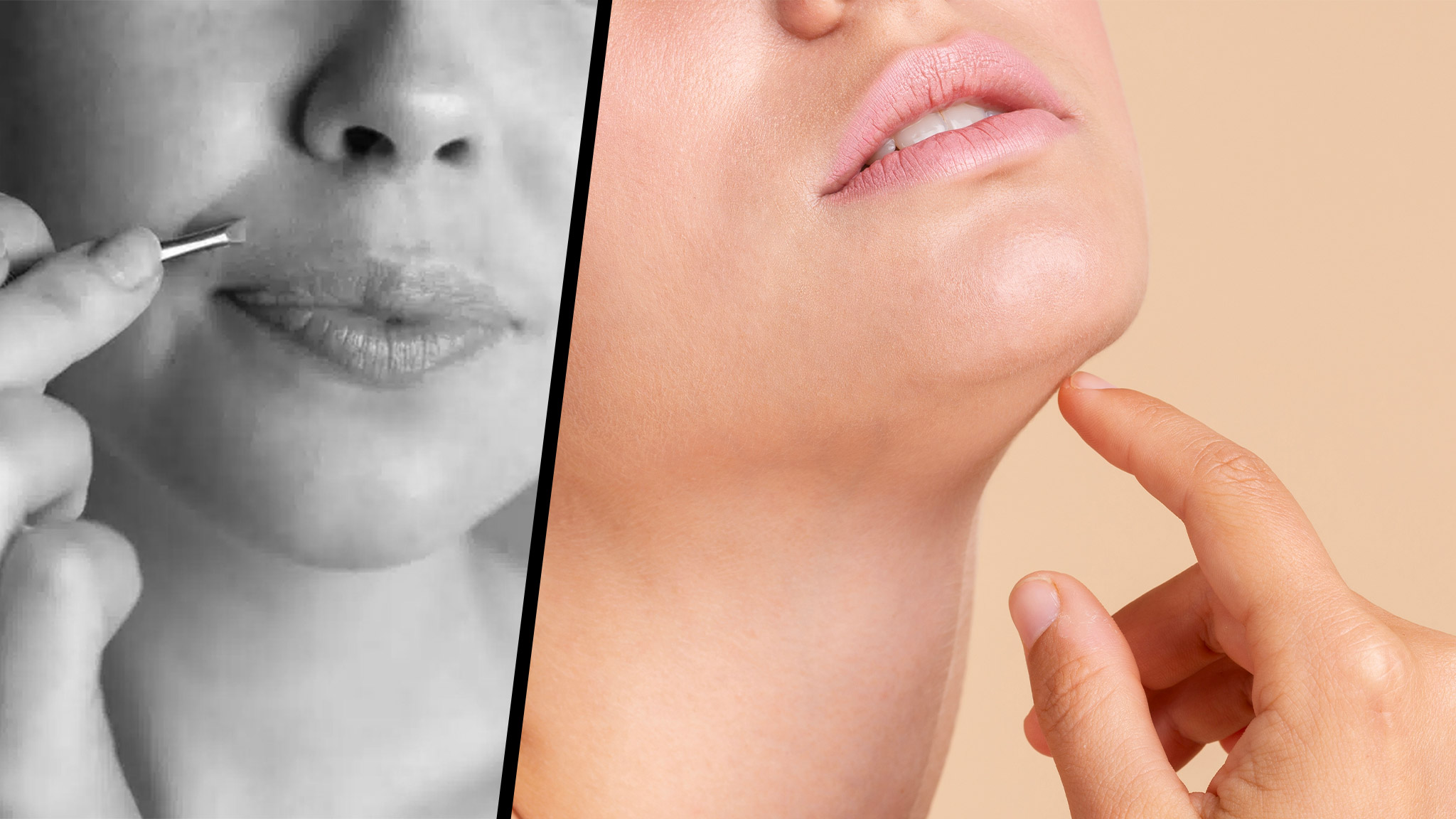 Peli sul viso: ecco la soluzione perfetta per rimuovere anche quelli più corti